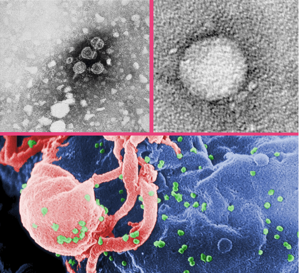 Collage di diversi tipi di batteri e virus